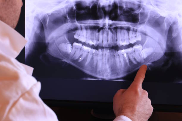 Best Emergency Root Canal Treatment in Blackstone, VA