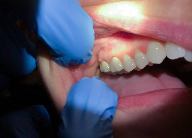 Best Weekend Emergency Dentist in Blackstone, VA